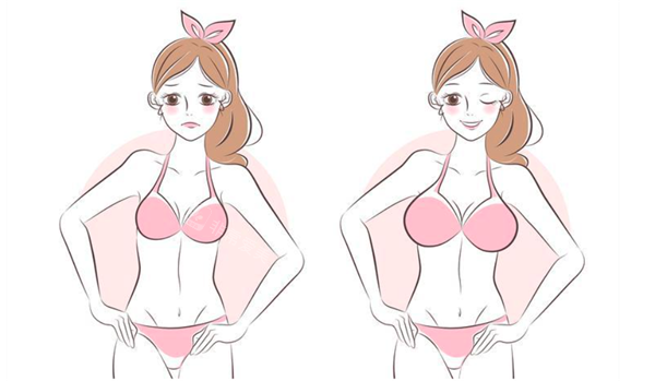 隆胸手术对比 隆胸手术对比