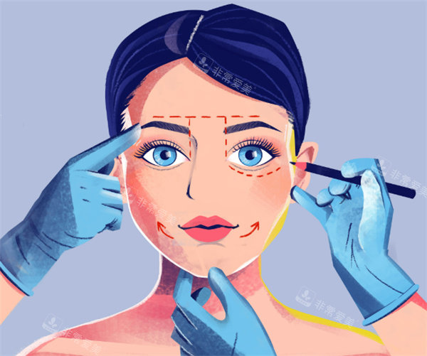 面部轮廓整形手术卡通图