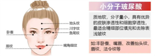 小分子玻尿酸简介