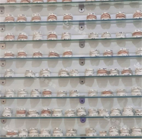 昆明松鼠口腔牙模展示柜