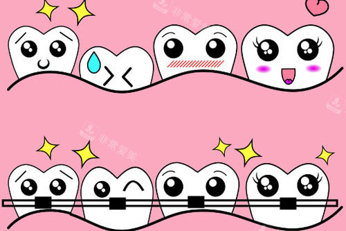牙齿矫正反弹卡通图
