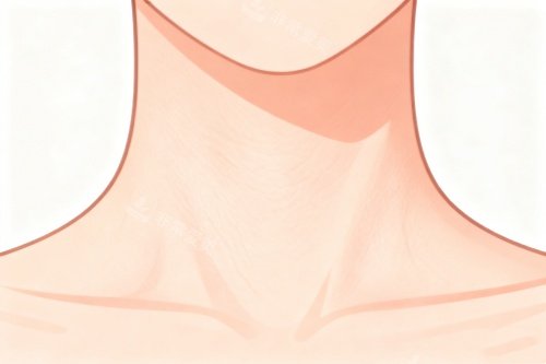 颈纹卡通图展示 颈纹卡通图展示