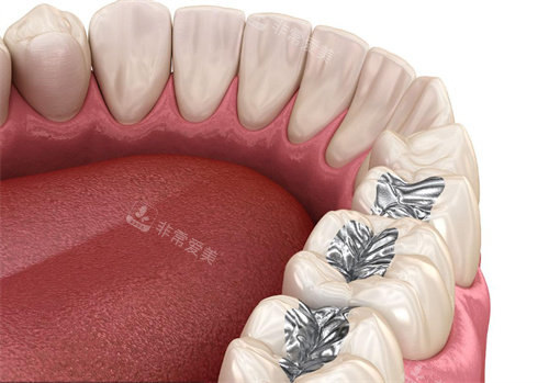牙齿修复卡通图片