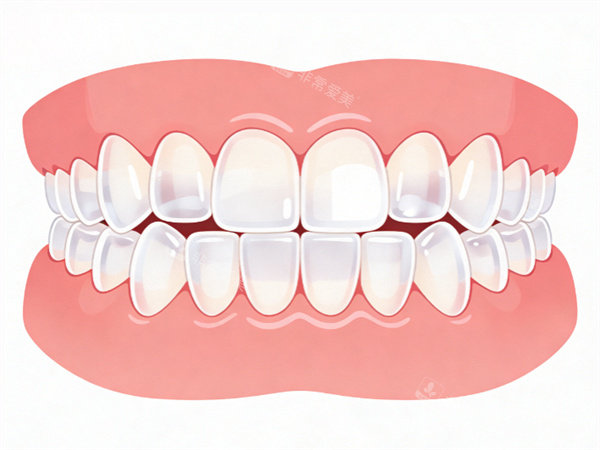 整齐牙齿动画示意图