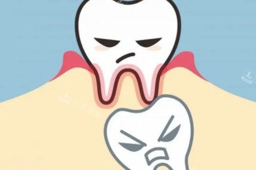 小孩子乳牙滞留图片展示