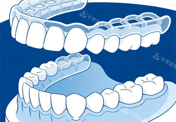 牙齿隐形矫正示意图