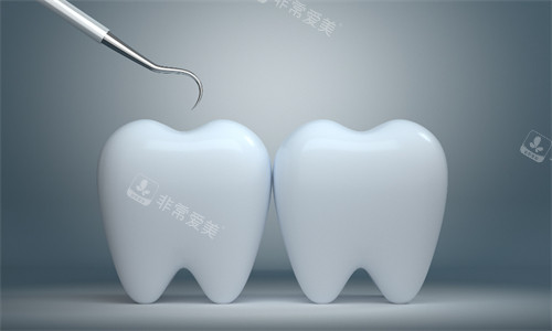 牙齿检查
