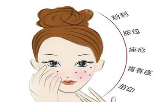 激光美肤适应症 激光美肤适应症