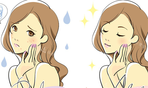 祛痘前后对比图片