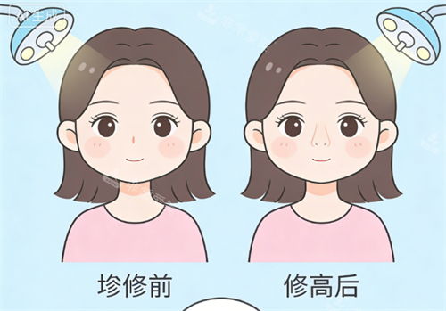 鼻修复前后的对比