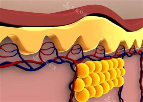 脂肪在皮下的展示图