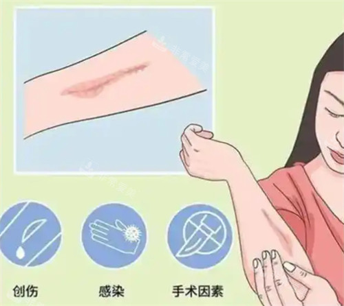 造成疤痕的原因 造成疤痕的原因