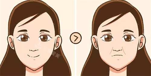 祛法令纹前后对比卡通图