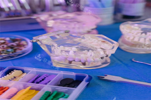 牙齿正畸宣传图