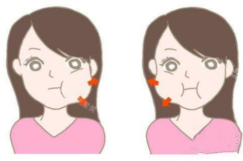 咬肌肥大卡通图