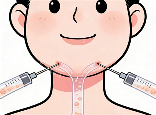 面部吸脂示意图