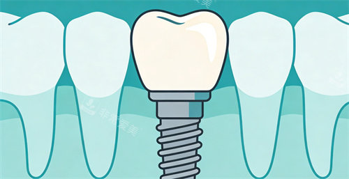 种植牙卡通种植展示照片