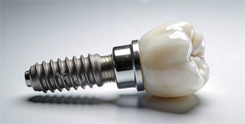 种植牙图片照片