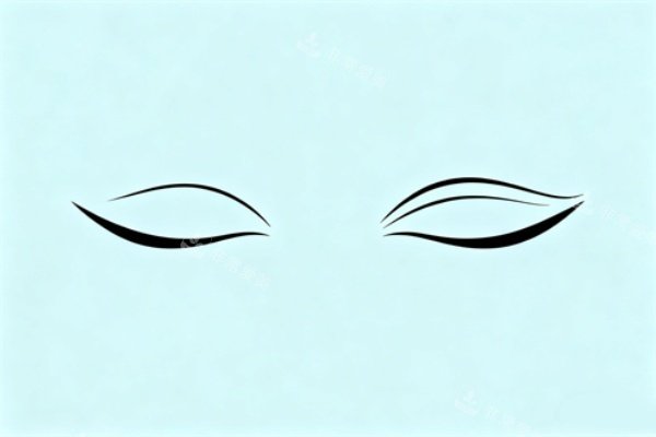 割双眼皮展示图一览