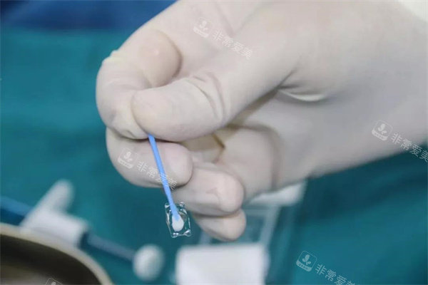 icl人工晶体真实图