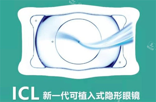 ICL介绍