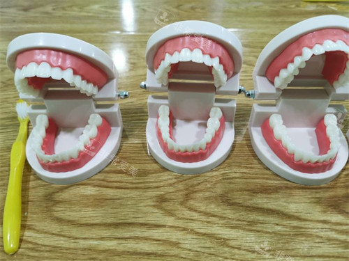 三个牙齿模型示意图