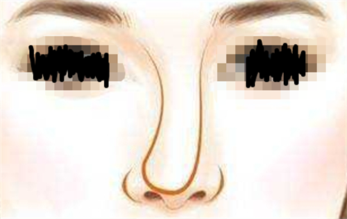 韩国歪鼻矫正手术真实经历，术后鼻子端正自然，美貌与形象都有提升！