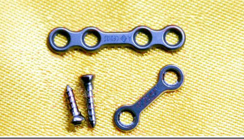 面部轮廓整形固定用钛钉钛板实物展示图