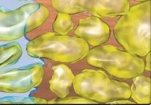 韩国劳波尔整形医院吸脂怎么样？深度解析医生团队与真实修复过程供参考