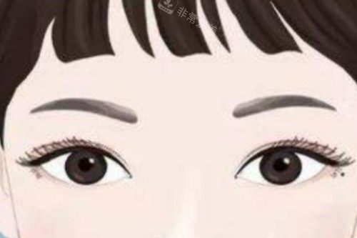 全切双眼皮卡通图一览