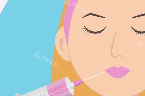 面部注射皮肤展示图