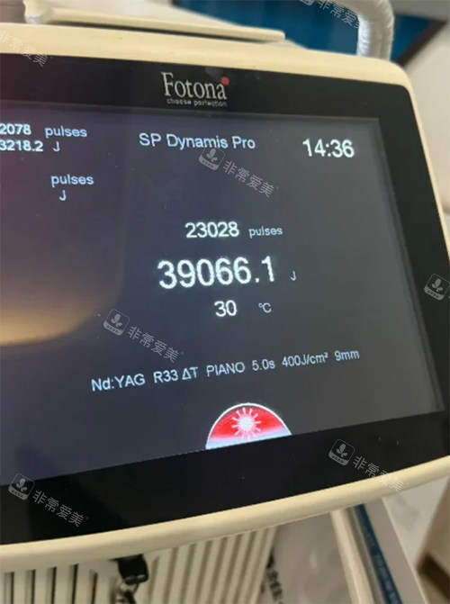 歐洲之星fotona照片 歐洲之星fotona照片