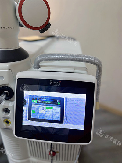 歐洲之星fotona4d儀器圖 歐洲之星fotona4d儀器圖