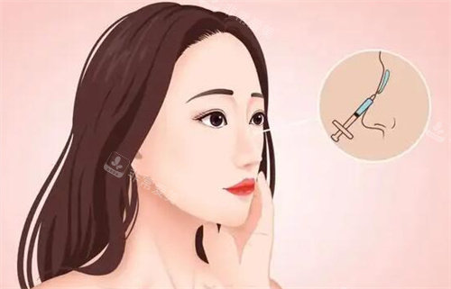 注射隆鼻卡通圖