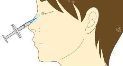 注射隆鼻側(cè)面