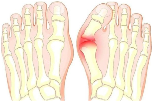 大腳骨腳步骨頭透視圖 大腳骨腳步骨頭透視圖