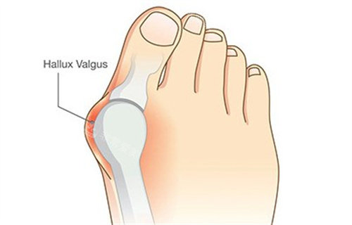 大腳骨解析 大腳骨解析