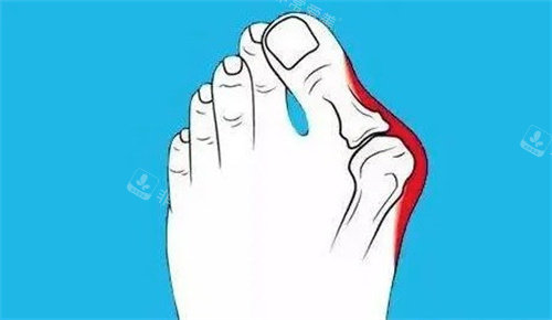 大腳骨是什么 大腳骨是什么