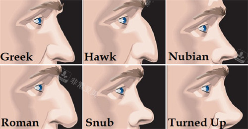 不同類型需要矯正的鼻子 不同類型需要矯正的鼻子