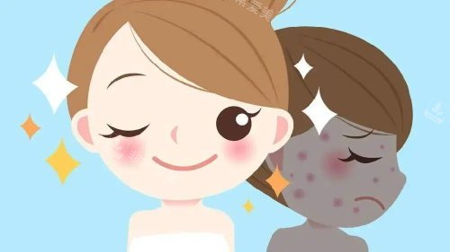 光子嫩膚后的成效 光子嫩膚后的成效