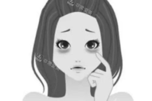 黑眼圈卡通圖