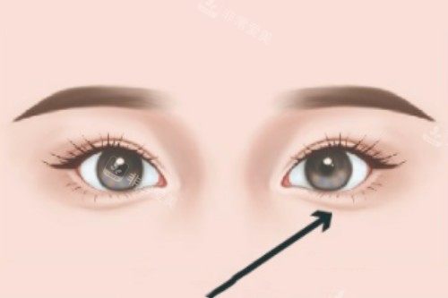 臥蠶卡通圖 臥蠶卡通圖