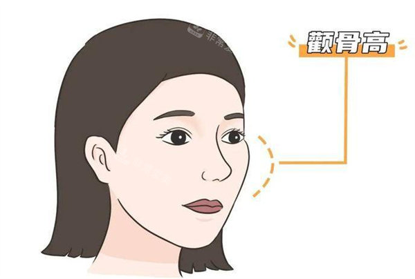 亲历韩国HIGH-3D颧骨手术，从自卑敏感到自信从容，我终于摆脱容貌焦虑！