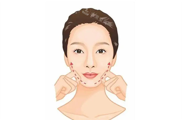 面部 提升效果圖 面部 提升效果圖