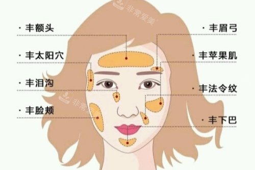 自體脂肪面部填充卡通圖一覽