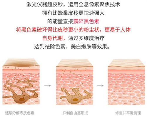 激光祛斑前后的對(duì)比