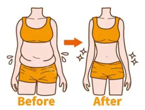 腰腹吸脂前后對比圖