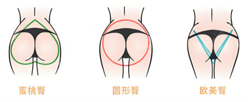 多種臀部形態(tài)素材圖片