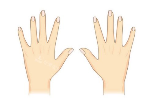 手背拉皮術(shù)后示意圖