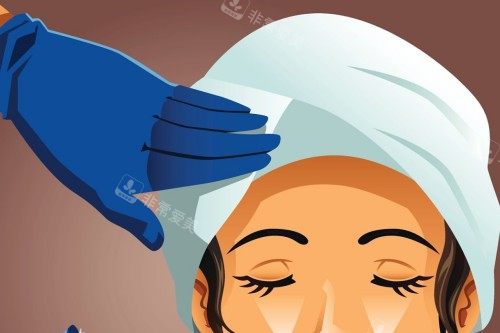 面部注射卡通示意圖